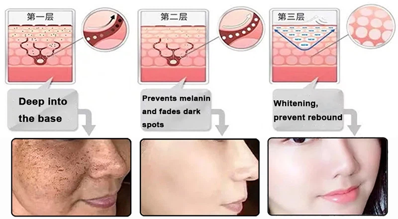 sepiwhite msh powder Whitening sepiwhite msh powder Whitening